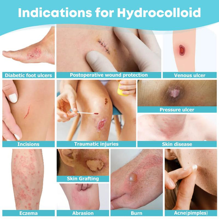 Cut-to-Size Hydrocolloid Roll – Flexible, Waterproof Occlusive Dressing