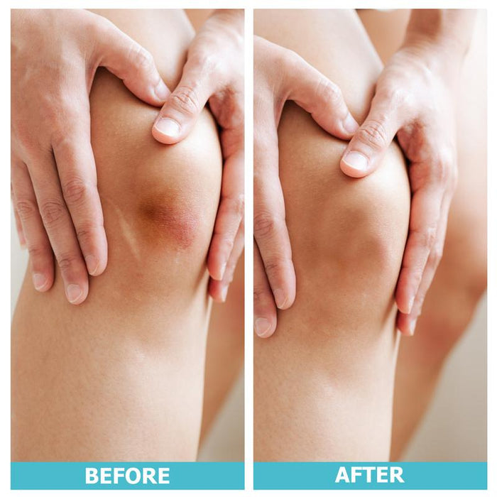 Cut-to-Size Hydrocolloid Roll – Flexible, Waterproof Occlusive Dressing