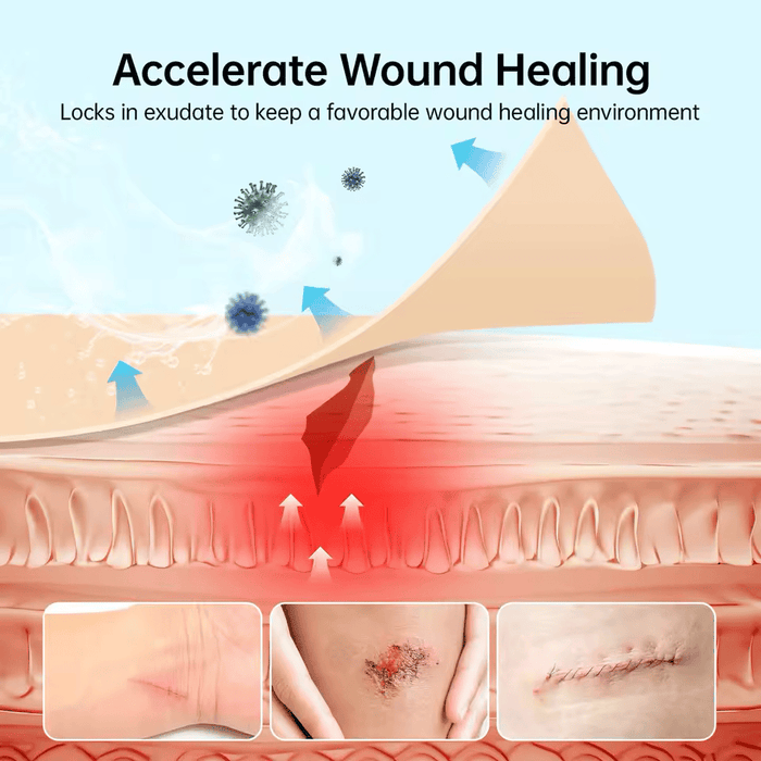 Cut-to-Size Hydrocolloid Roll – Flexible, Waterproof Occlusive Dressing